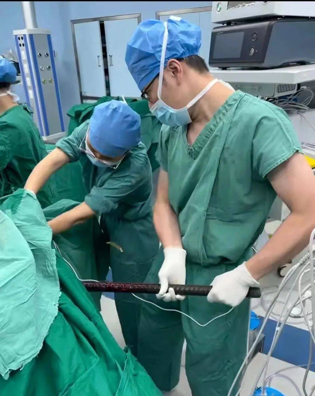 佛山一男子意外从高空坠落,1.5米长钢筋从肛门贯穿胸腔......