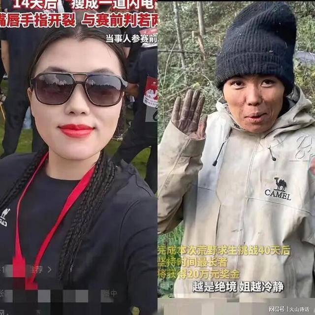 女子参加湖南荒野求生,14天后瘦成一道闪电,嘴唇手指裂开 女子参加湖南荒野求生,14天后瘦成一道闪电,嘴唇手指裂开